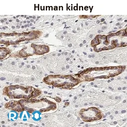 Calcium Sensing Receptor antibody [HL2357]